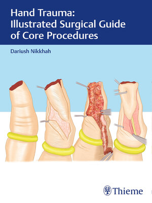 cover image of Hand Trauma